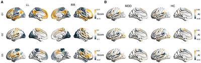 Altered asymmetry of functional connectome gradients in major depressive disorder